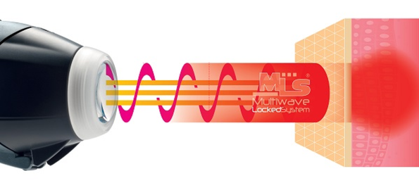 How does MLS Laser Therapy at Harrogate Footman Ltd work